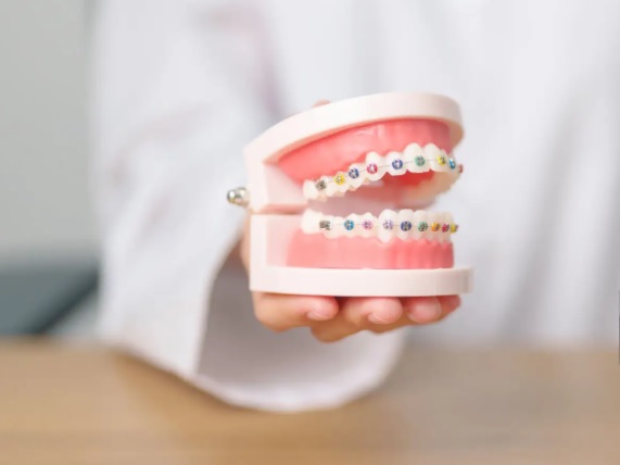 Kiedy najlepiej założyć aparat na zęby – w dzieciństwie czy w dorosłości?