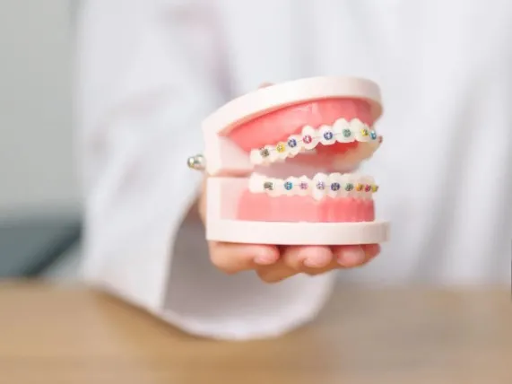 Kiedy najlepiej założyć aparat na zęby – w dzieciństwie czy w dorosłości?