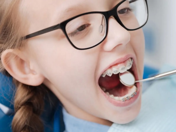 Jak zmienia się skuteczność leczenia ortodontycznego u dorosłych?